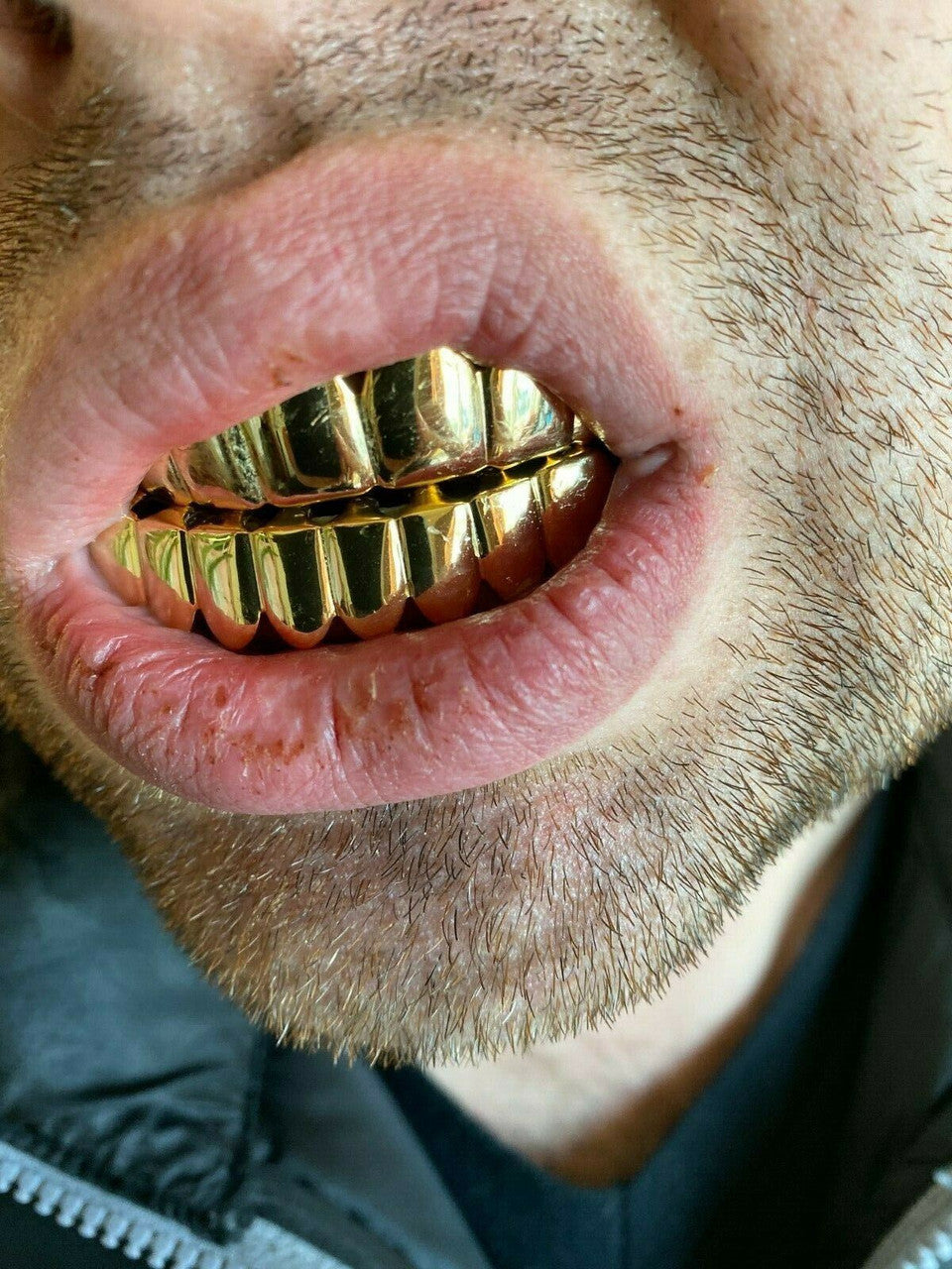 Real 925 Sterling Silver Gold Finish GRILLZ -  Grills 6 8 Or Single Teeth